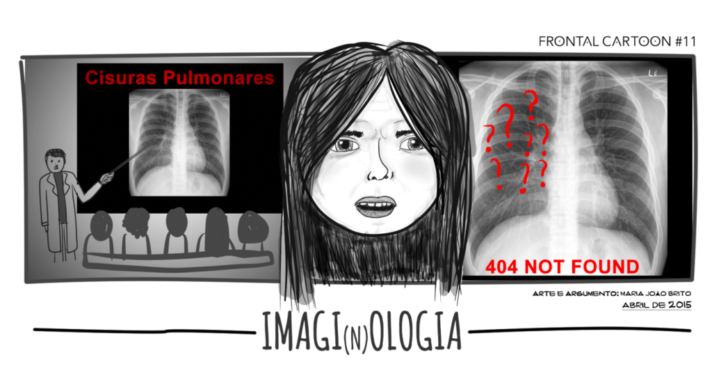 cisuras pulmonares; cartoon; imagiologia